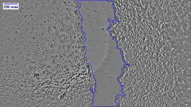 C:\Users\Сарвиноз\Desktop\20260610-122527-316-1 5 mkM 0s.tif
